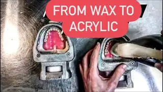 HOW DENTURES ARE MADE (Processing dentures using ivocap injection system) 