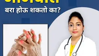 Aamvat, Srdp Treatment