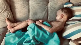 ГОСПИТАЛИЗАЦИЯ В БОЛЬНИЦУ | Вынужденная трансплантация костного мозга  | Прекратите | Жара под 40