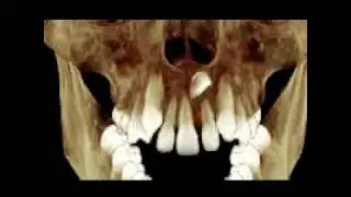 3D X-Ray (Cone-Beam CT)