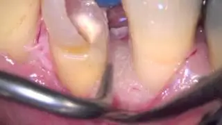 Perio-Mix Annual course 2015