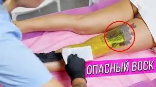 Опасный воск! Какие последствия могут быть от ВАКСИНГА?