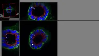 Performing Simple Measurements in Volocity 3D Image Analysis Software