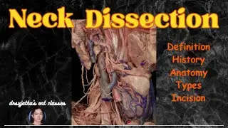 227.NECK DISSECTION : definition,Types,Incisions and much more... 