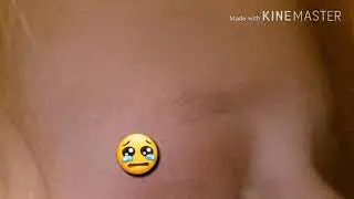 И Мне больно...
