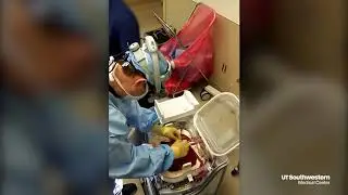 New method of liver transplant keeps organ at body temperature