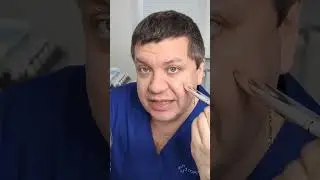 Осторожно! Сосуды на лице!