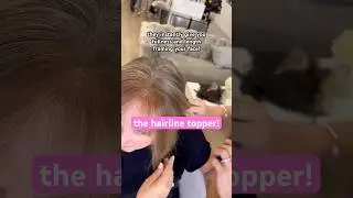 The Hairline Topper! 🫶 
