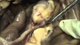 Abdominopelvic Cavity part 2
