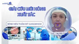 Giải cứu mũi hỏng xuất sắc tại Bệnh viện thẩm mỹ Gangwhoo