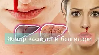 Жигар касаллиги белгилари. Жигар циррозини олдини олиш усуллари