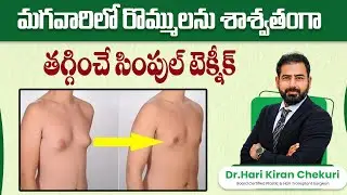 What is the Best Treatment for Gynecomastia || How to Reduce Male Chest Fat || ReDefine Channel