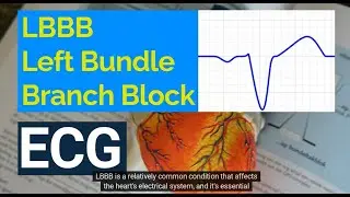 Understanding Left Bundle Branch Block (LBBB) on ECG:  Causes, Symptoms, and Treatment.