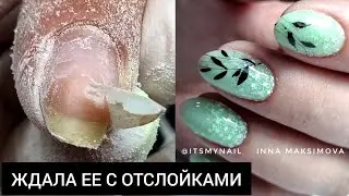 результат НА ЛИЦО - ОТСЛОЙКИ