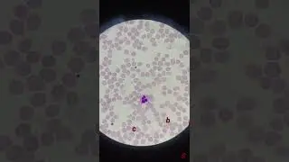 WBC under microscope 