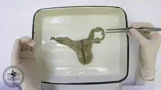 Спланхнология, анатомия маточной трубы