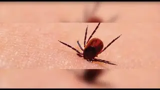 Lyme Disease | Chris’s Story