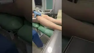Жидкость в коленном суставе ( синовиит) . Удаление жидкости из коленного сустава
