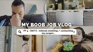 1 week post boob job *vlog 4 ( intense swelling / breakdown)