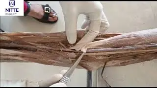 Demonstration of front of arm