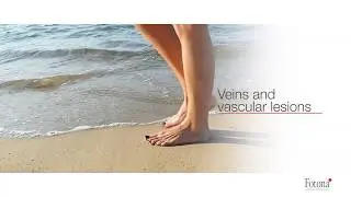 Lesiones vasculares y varices