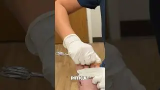 Pin STUCK in a toe? 😳🤯