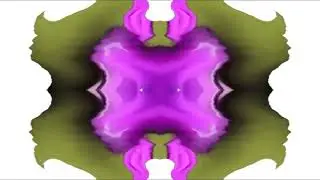 Preview 2B V35 (My Version) Super Effects