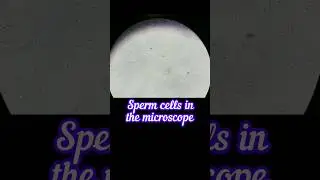 Sperm count test | Sperm count kaise hota hai | Sperm cells in the microscope #microbiology #shorts