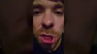 между футбольным мячом и ежом