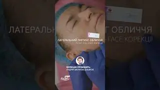 🔥Латеральний ліфтинг від Андрія Ваганова-Дашкова 