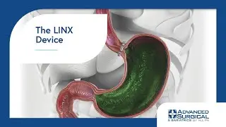 The LINX Device 3D Animation