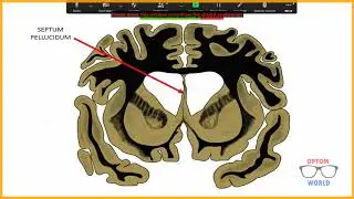 Ventricles of the Brain in Urdu/Hindi
