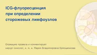 ICG-флуоресценция при определении сторожевых лимфоузлов с помощью видеосистемы IMAGE1 S RUBINA