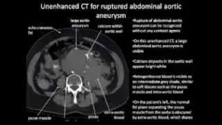 Emrgency Imaging  Pearls