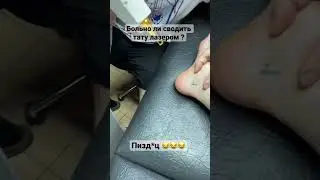 - это пи***ц ! Больно ли сводить тату лазером  ?