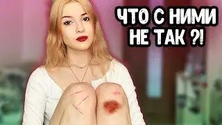 ЧТО НЕ ТАК С МОИМИ КОЛЕНЯМИ?!