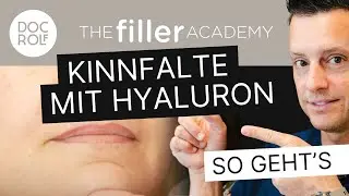 KINNFALTE mit HYALURON FILLER unterspritzen – TFA by doc.rolf