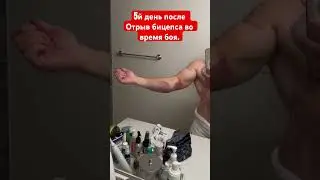 #евгенийкурданов отрыв бицепса во время боя. Бэрнакл. Травма #boxing #bkfc
