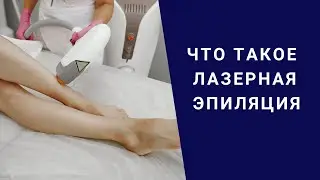 ЧТО ТАКОЕ ЛАЗЕРНАЯ ЭПИЛЯЦИЯ
