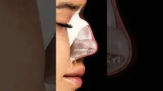 SKIN ⭕️ The skin is a superficial structure covering all elements of the outer nose. #kaminskyi