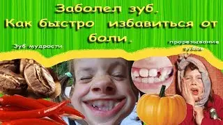 Разболелся зуб. Как быстро снять боль.