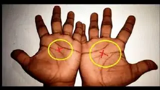 Cross or X palm in the palm of your hand