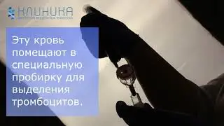 Prp-Терапия