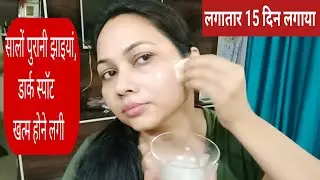 Aloe vera gel for skin whitening / Aloe vera face pack / Aloe vera facial at home / Alovera facial