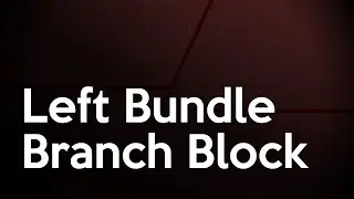 Left Bundle Branch Block ECG