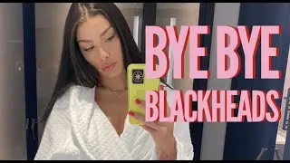 My top tips for BLACKHEADS! Get rid of them and get the skin of your dreams!