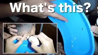 Mystery Foreign Body Stuck In Little Boy's Ear Removed!