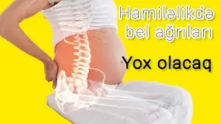 hamilelikde bel agrilarına son vermək