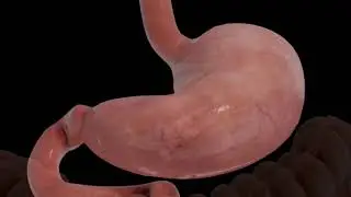 Gastric Sleeve Procedure (Sleeve Gastrectomy)