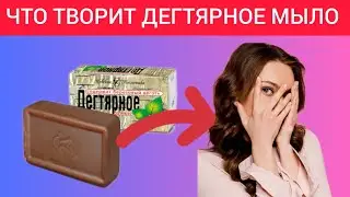 Вот что творит ДЕГТЯРНОЕ МЫЛО с телом! 90% пользующихся не знают об этом!